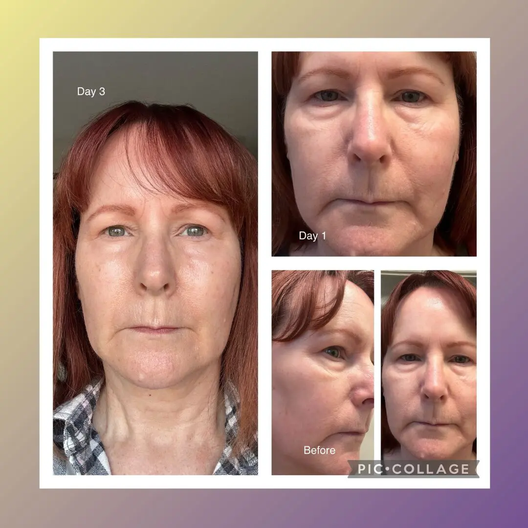 Collage showing woman's face over three days.