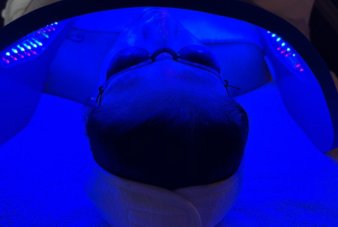 featured image of led treatment