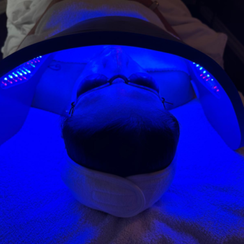 featured image of led treatment