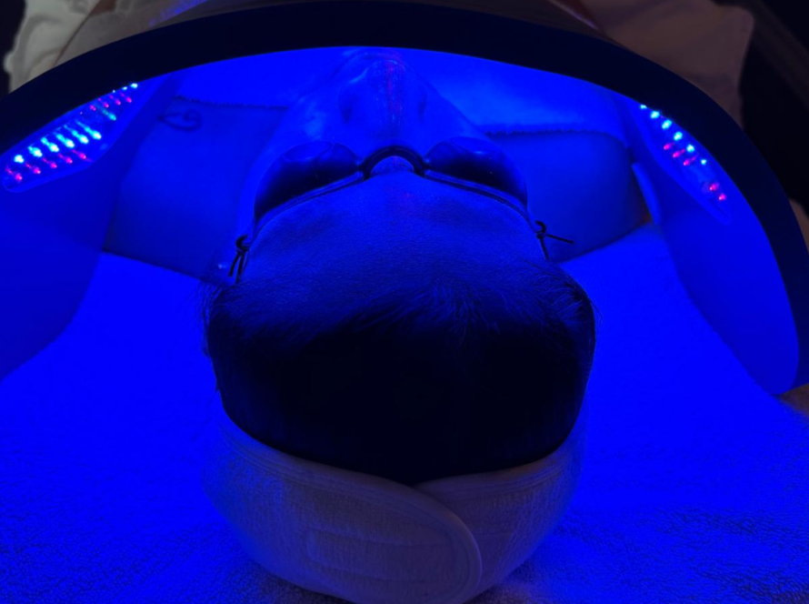 featured image of led treatment