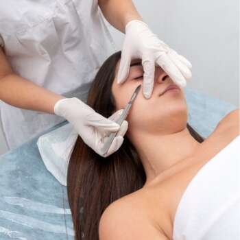 dermaplaning service